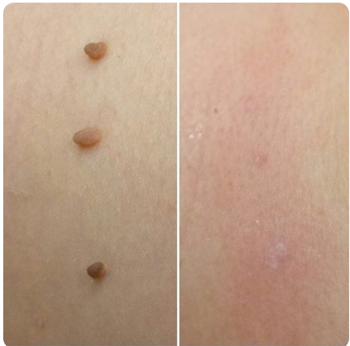 Dermaclaré™ – Sérum Facial Restaurador & Iluminador